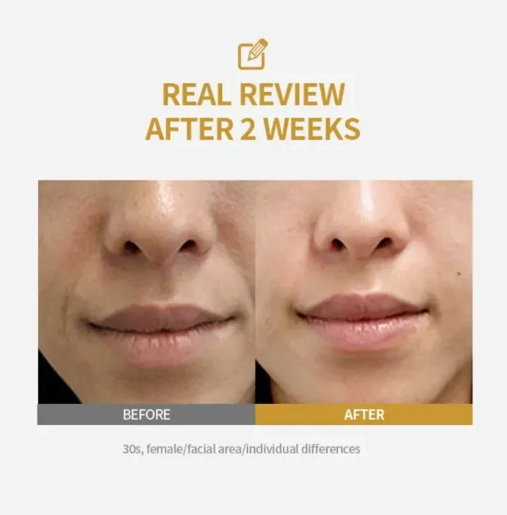 Sérum Facial MillahGlow — Ácido Kójico & Cúrcuma & Niacinamida — Anti-Manchas & Melasma